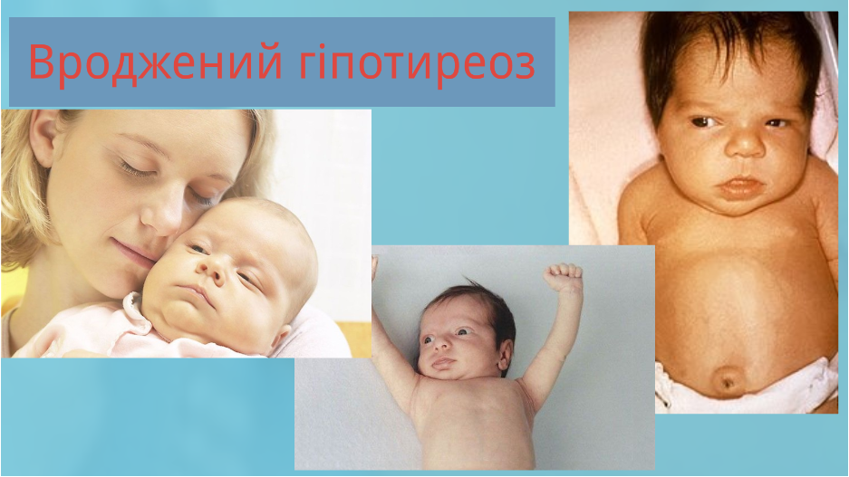 Скринінг-програми для новонароджених. by Olga - Ourboox.com