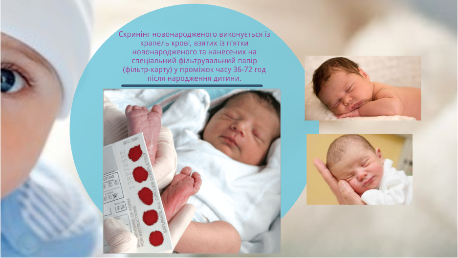 Скринінг-програми для новонароджених. by Olga - Ourboox.com