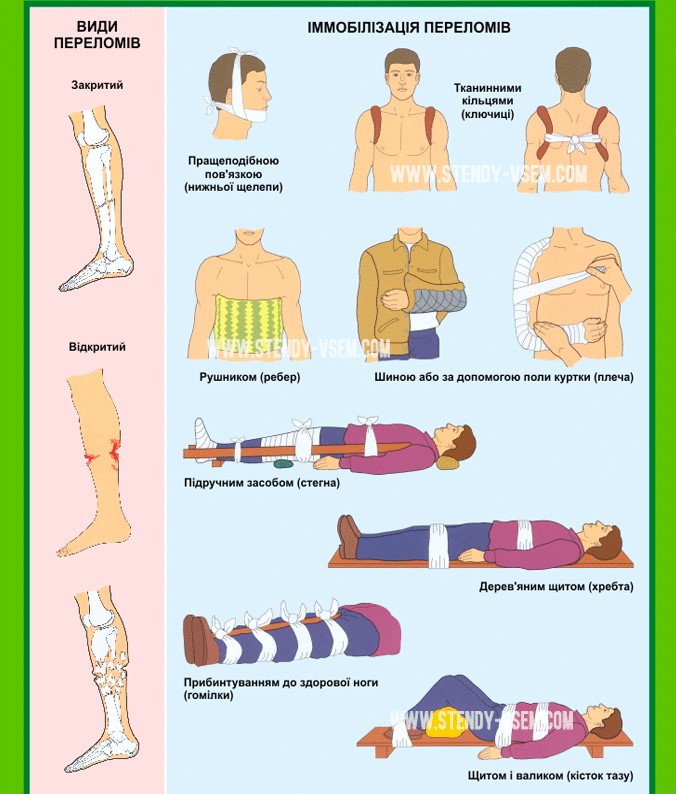 Надання першої допомоги потерпілим при нещасних випадках by Lora - Ourboox.com