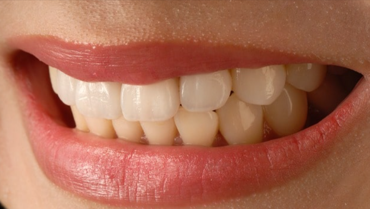 Power Bite Reviews – Best Supplement For Supporting Dental health by Power Bite Reviews - Ourboox.com