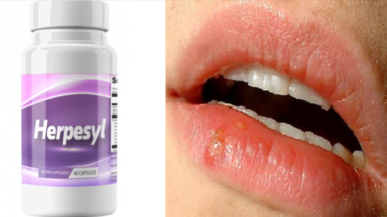 Herpesyl Reviews : Does It Work? Critical Consumer Update! 2023 by Herpesyl Reviews - Ourboox.com