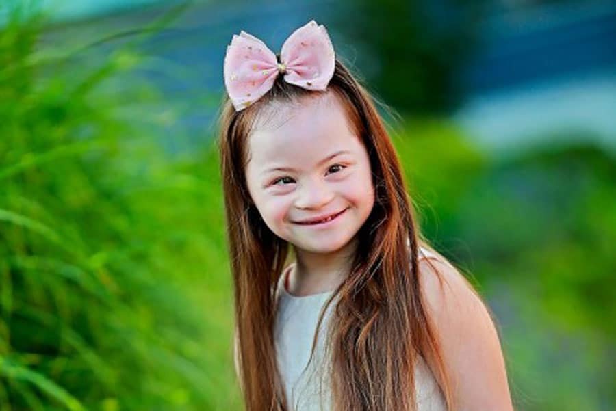 Синдром на Даун