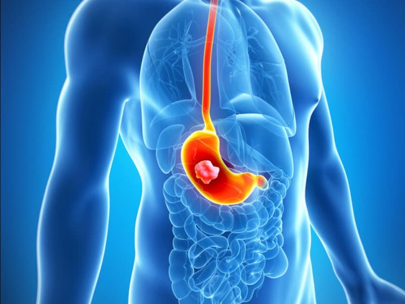 Травлення в шлунку by anastasia - Ourboox.com