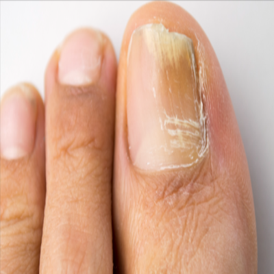 Kerassentials Reviews – What Do The Customers Think About This Oil? by Kerassentials Reviews - Ourboox.com