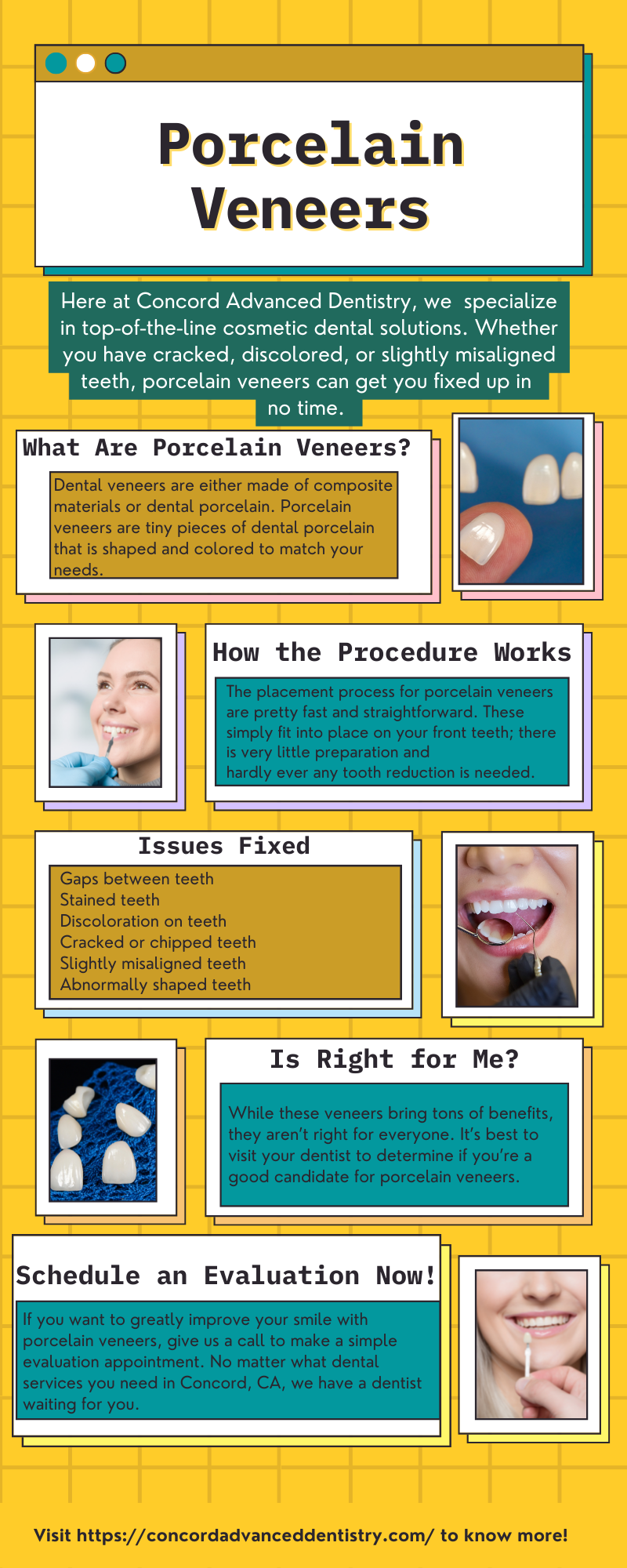 Porcelain Veneers by Caleb Addison - Ourboox.com