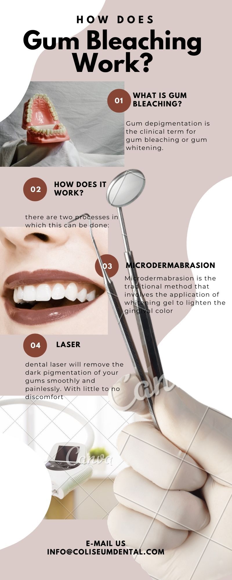 How Does Gum Bleaching Work? by Jane Simpson - Ourboox.com