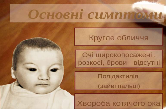 Синдром одержав свою назву через характерний плач дітей (він аналогічний нявканню кошеняти, крику кішки), які страждають від цього захворювання. Це явище відбувається через проблеми з гортанню і нервовою системою. Близько 1/3 дітей втрачають цю особливу характерну рису до 2 років.