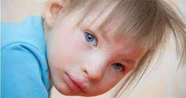 Хромосомні хвороби “Синдром котячого крику” by Volkotrub - Illustrated by Підготувала учениця 10-А класу Волкотруб Софія - Ourboox.com