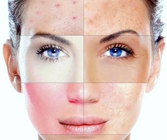 Краса і здоров’я. Функції шкіри. Типи шкіри by Volotivska Sofia - Illustrated by Софія Волотівська - Ourboox.com